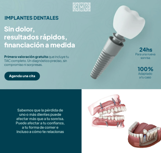 Email CEMEQ — Implantes dentales