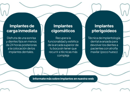 Email CEMEQ — Tipos de implantes